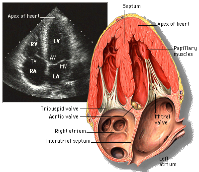 device for intravascular ultrasound transducers for contrast imaging