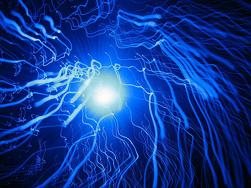 High Sensitity Fiber Optic Stethoscope for use in Biomedical Applications