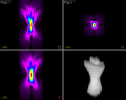 Multi-Color 3D Imaging Using Multi-Focus Microscopy for Biomedical Applications