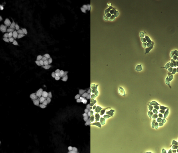 Sophisticated microscope design leads to faster imaging